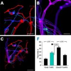 blocking-yap-tead/lox-signaling-reduces-lung-fibrosis
