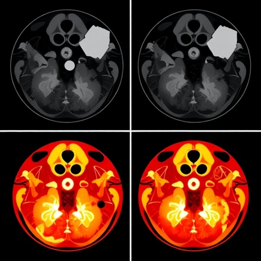 ai-predicts-sinus-surgery-outcomes-from-images