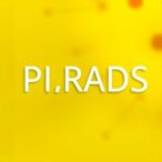 pi-rads-v2.1-plus-amide-transfer-boosts-detection