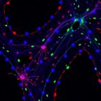 microglia-chromatin-states-reveal-alzheimer’s-spatial-patterns