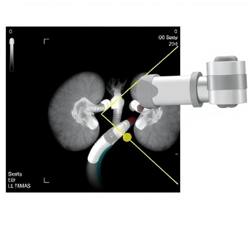 ultrasound-guided-robotic-percutaneous-nephrolithotomy-advances