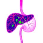 prognostic-nutrition-index-predicts-liver-cancer-outcomes