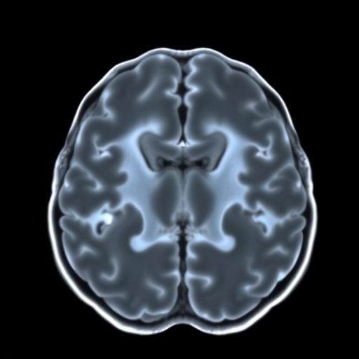 neuroimaging-reveals-cognitive-traits-in-moderate-preterms
