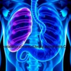 carvedilol-boosts-paclitaxel-effect-in-resistant-gastric-cancer