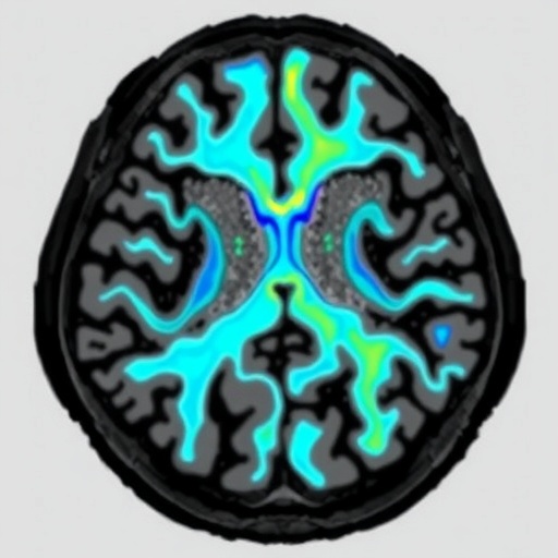 optimizing-inversion-time-in-postmortem-1.5t-flair-imaging