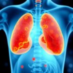 immune-markers-in-breast-cancer-and-chemotherapy-response