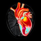 new-advances-in-cardiac-mri-for-congenital-heart-disease