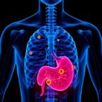 lapatinib-and-nnc-55-0396-boost-gastric-cancer-fight