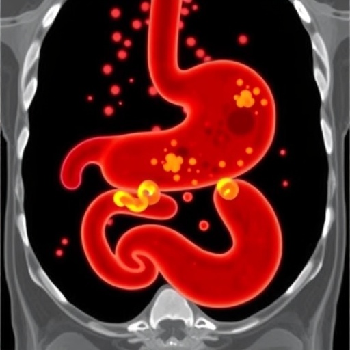 metastatic-gastric-cancer:-survival-varies-by-site