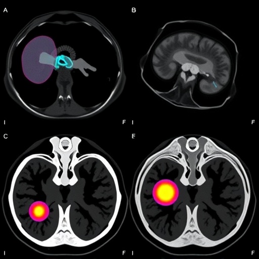 exploring-renal-pseudotumors-in-pediatric-imaging
