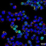 self-assembling-nanoparticles-at-room-temp-could-transform-drug-delivery
