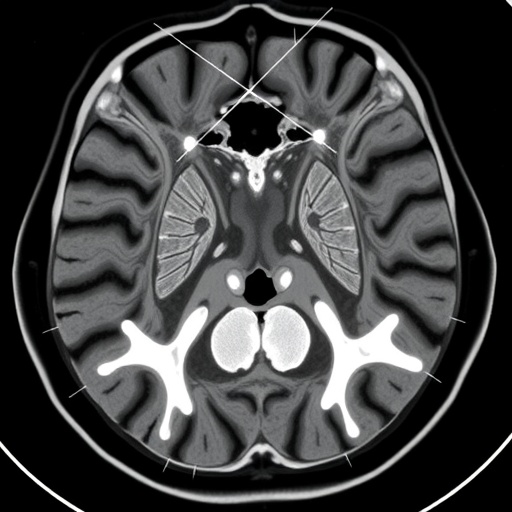 enhancing-pediatric-abdominal-mri-quality-with-deep-learning