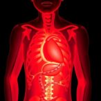 stenting-the-superior-vena-cava-in-youths