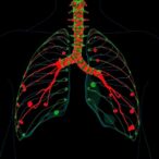 circulating-hsp70-signals-early-thoracic-cancer-spread