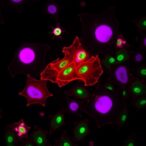 tanshinone-iia-boosts-olaparib-killing-breast-cancer-cells