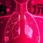 non-coding-lung-cancer-genes-found-in-13,722-chinese