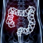 sericin-silver-nanoparticles-combat-colorectal-cancer-effectively