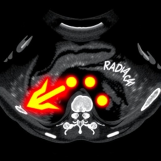 ultrasound-s-detect-enhances-bi-rads-4-nodule-analysis