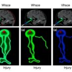 validating-injury-simulations-using-muscle-data-under-anesthesia
