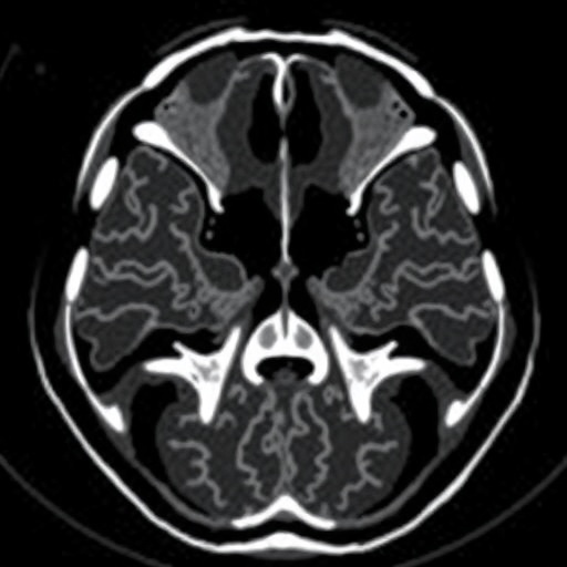 frontal-sinus-ct:-advancing-forensic-id-accuracy