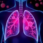 novel-approach-enhances-immunotherapy-effectiveness-against-the-most-aggressive-lung-cancer