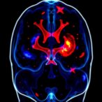 d-cysteine-halts-tumor-growth-by-blocking-nfs1