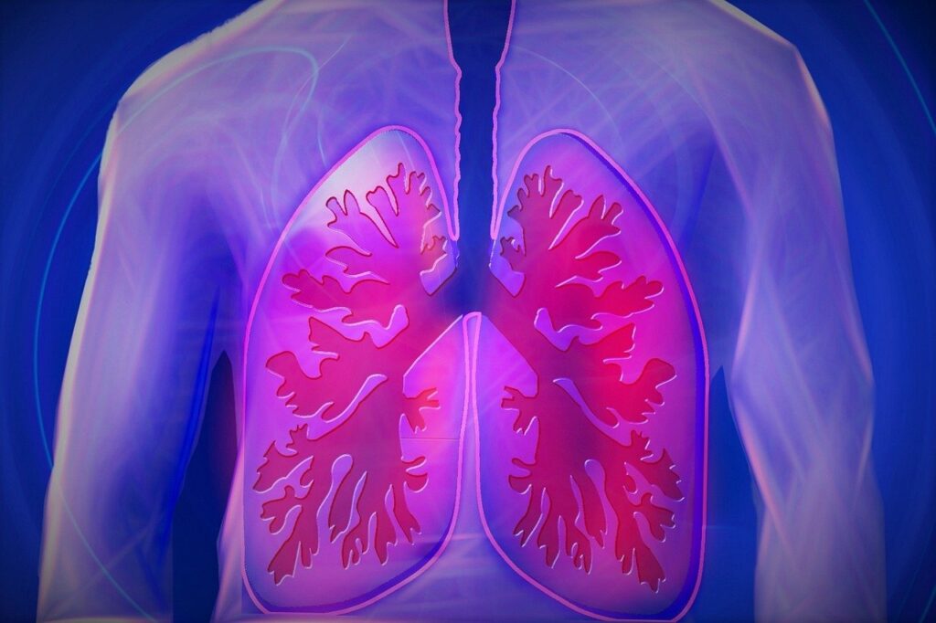 puretech-launches-celea-therapeutics-to-develop-highly-touted-lung-disease-candidate