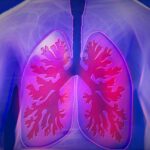 puretech-launches-celea-therapeutics-to-develop-highly-touted-lung-disease-candidate