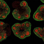 how-organoids-are-revolutionizing-neuroscience-research