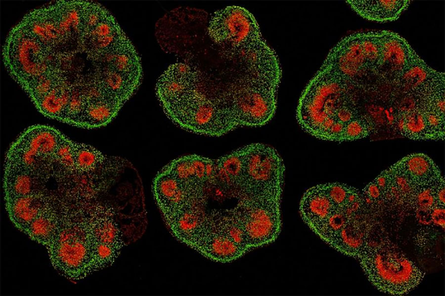 how-organoids-are-revolutionizing-neuroscience-research
