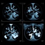 rsna-ai-challenge-models-demonstrate-independent-mammogram-interpretation-capabilities
