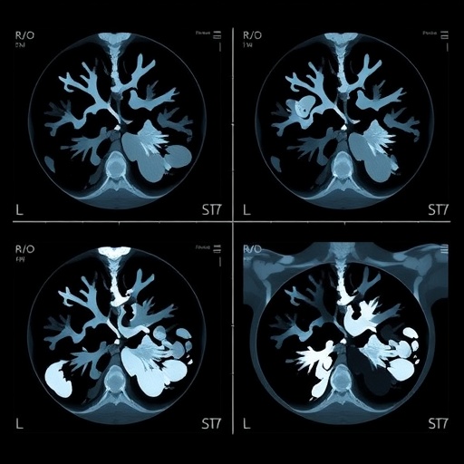 rsna-ai-challenge-models-demonstrate-independent-mammogram-interpretation-capabilities