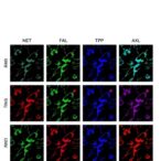 axl-inhibitor-tp-0903-induces-neuroblastoma-apoptosis