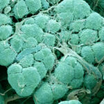 oxygenated-implant-sustains-insulin-cells-in-rats,-no-immunosuppression