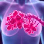 lead-in-breast-cancer-tissue-linked-to-dna-instability