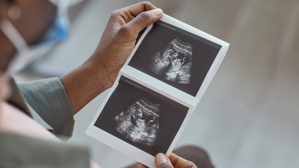 philips-to-invest-$150m-in-us-manufacturing-base,-including-ultrasound-site-expansion