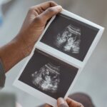 philips-to-invest-$150m-in-us-manufacturing-base,-including-ultrasound-site-expansion