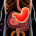 gallbladder-removal-disrupts-gut-microbes,-fuels-tumors