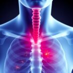 comparing-treatments-for-advanced-esophageal-cancer