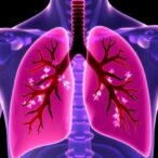 immune-combo-therapy-boosts-lung-cancer-outcomes