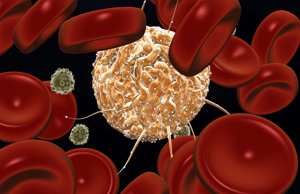 ischemia-drives-breast-cancer-growth-in-mice-by-weakening-immunity