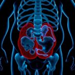 overweight,-obesity-linked-to-survival-in-metastatic-prostate-cancer
