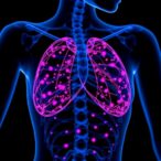 whole-exome-sequencing-links-fancm-to-er-negative-breast-cancer
