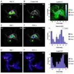 metabolic-profiling-reveals-rcc-drug-response