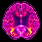 chinese-neurosurgical-journal-highlights-rare-central-nervous-system-tumor-study