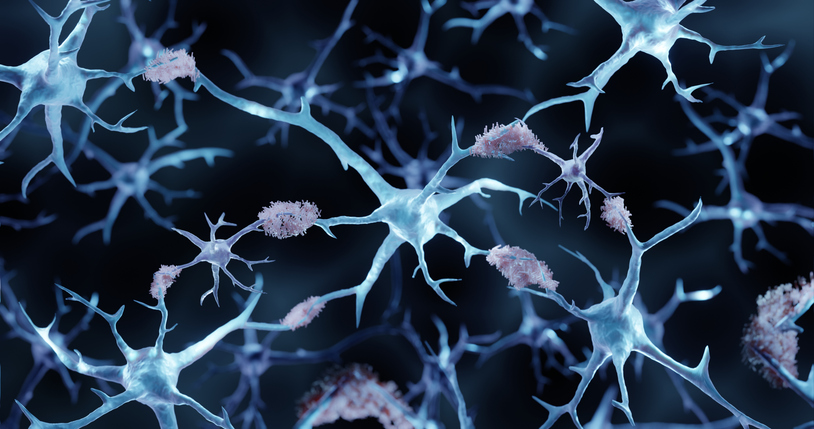 amyloid-attenuated-by-midkine-protein-in-alzheimer’s-mouse-model