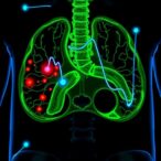 unraveling-sox2:-its-crucial-role-in-prostate-cancer-progression-and-therapy-resistance