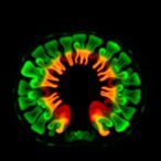 ahead-of-print:-the-journal-of-nuclear-medicine-tips-–-august-22,-2025