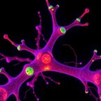 precise-time-controlled-cryo-optical-microscopy-advances