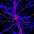 multi-omics-reveal-nerve-macrophages-in-polyneuropathy